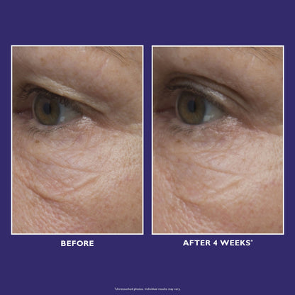 Ultimate Solution 5 Multitasking Eye Cream|15 ml / 0.5 fl oz